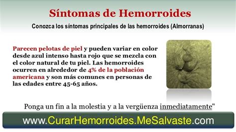 Hemorroides externas [almorranas]: qué son, síntomas y cómo。